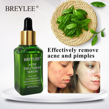 BREYLEE  Acne Treatment Serum