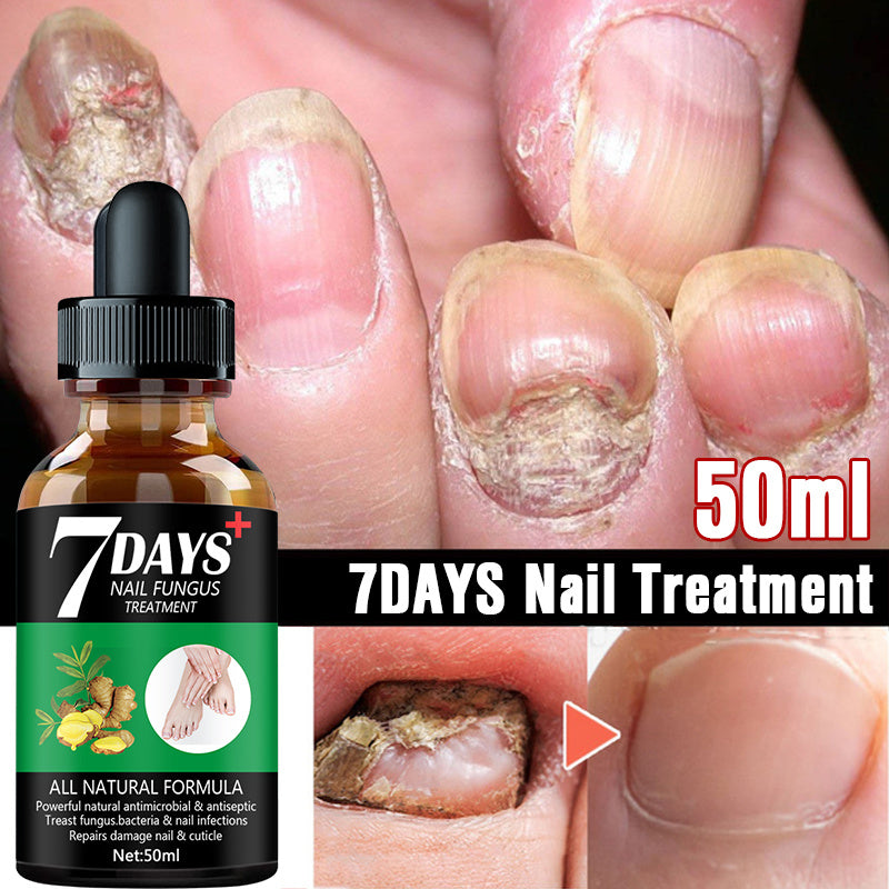 Nail Fungus Treatment Serum